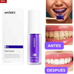 Espuma Blanqueadora Dental - Sonrisa radiante en 7 Dias