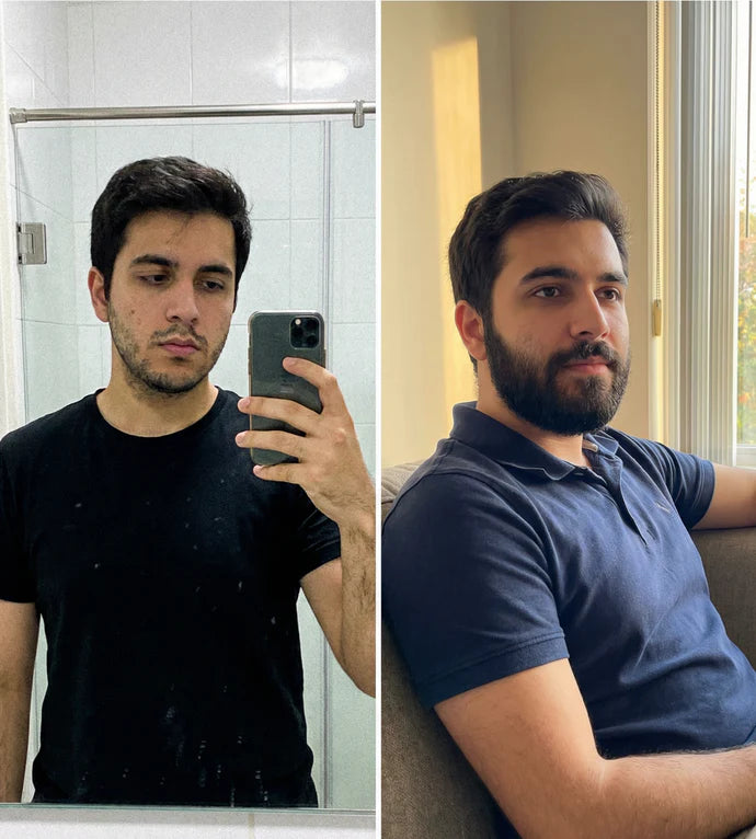 Antes y después usando Barba Power Ultra — crecimiento real de barba en semanas
